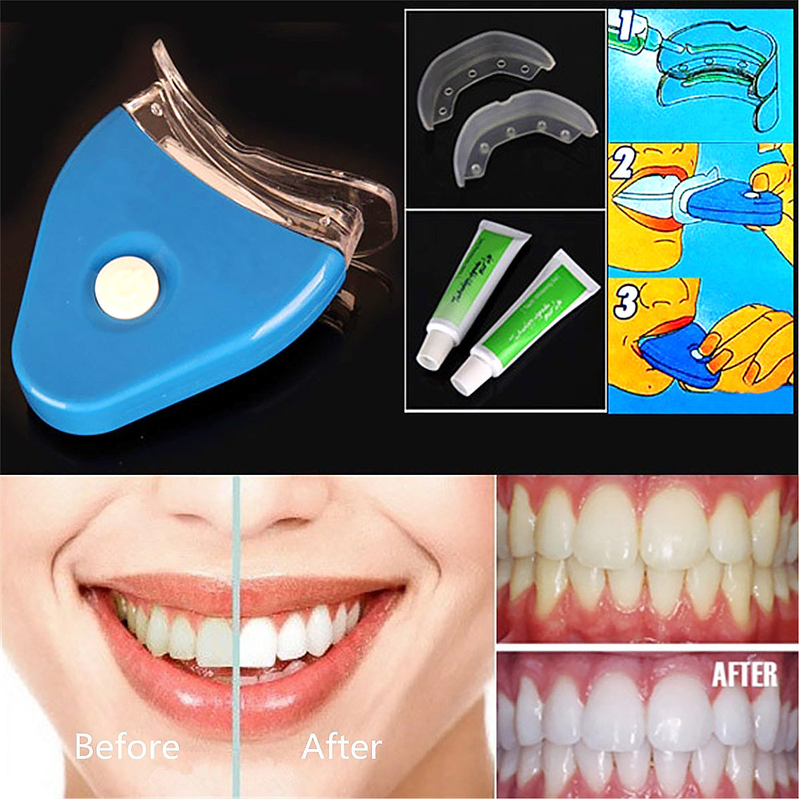 Oral Gel Teeth Tooth Whitening LED